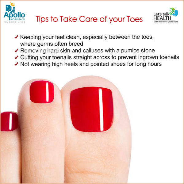 anithajj77's tweet photo. Tips Take Care of ur Toes http://t.co/dImufWXRio