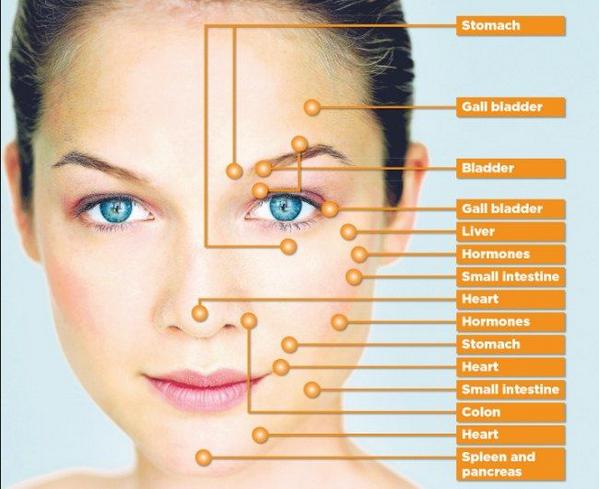 Acne Chart On Face