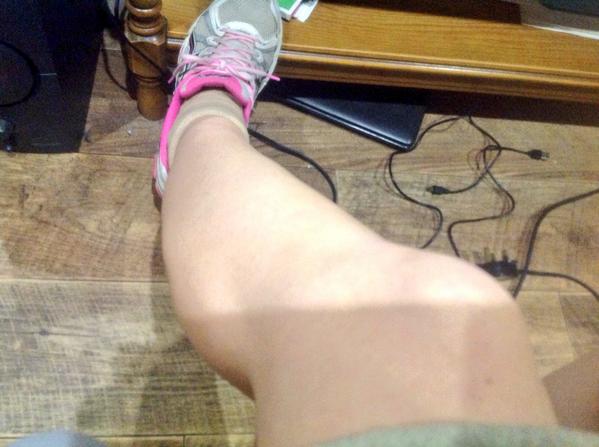 hughem22's tweet image. Glutes,calf and hamstring tightness.No exercise for at least two weeks, Physio&apos;s orders. #annoyed #sciaticaproblems