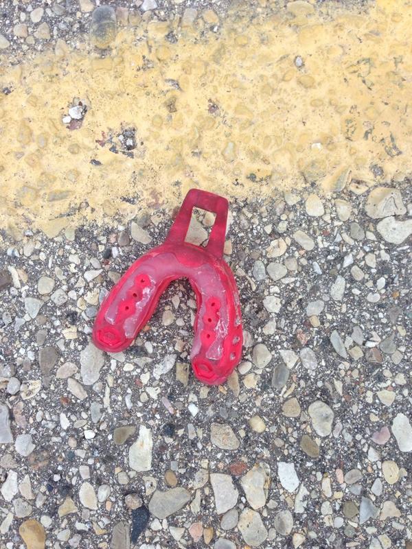 thenImabirrd's tweet photo. Things you find in Bradford parking lot #retainercase? @ifyoureabirrd http://t.co/CyBsutGhmW