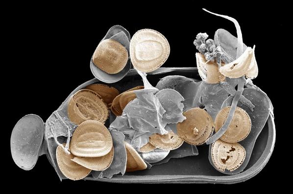 MicropalaeoSoc's tweet photo. 5/12 #TMS2014 Ostracod Cyprideis torosa filled with diatoms (Campylodiscus, orange). By Steffen Mischke @uni_iceland http://t.co/CDwllsTQBE