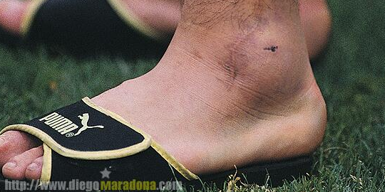 ¿Cuántos jugadores jugarían un partido con el tobillo así? Diego si. #FelizCumpleD10S.