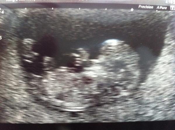 LtMatthewJB's tweet image. Brownie is in the oven :)