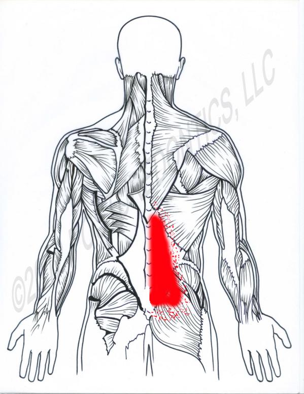 Posturedontics's tweet photo. Did you know that trigger points in the front of the hip can refer pain to the low back?   http://t.co/8Xqks8jJqZ http://t.co/X8A9pm9rUb