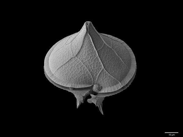 MicropalaeoSoc's tweet photo. Luka's winning dinoflagellate image also includes the coccolithophore Emiliania huxleyi #fossilfriday #TMS2014 http://t.co/jyqbUsOAmt