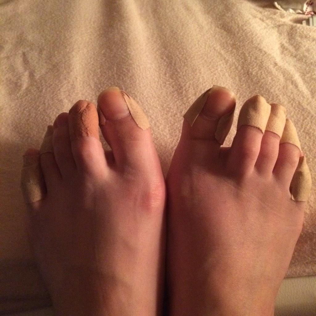 Ak バレリーナじゃないけど足指にテーピング 明日は華奢なヒールでカメラマンしなきゃだから完全武装です 巻き爪対策もできる範囲でしてみた Http T Co U9muyv4c2b Twitter