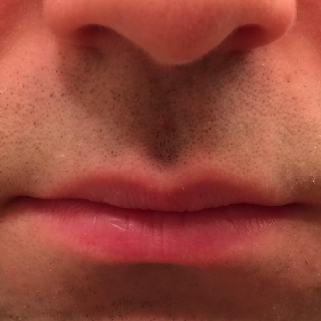 Have a lonely lip for the first day Movember.