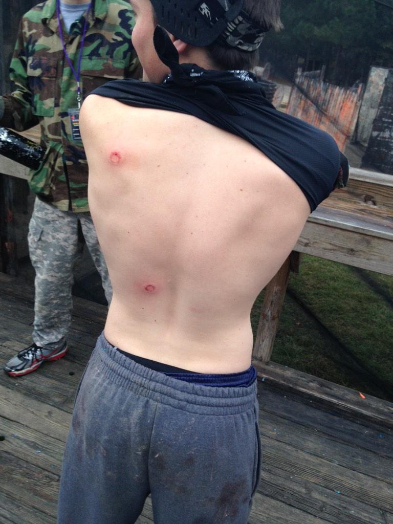 _Just_Joseph_'s tweet image. Battle wounds from paintball with EV today 🔫 so much fun. Got six kills in one game 👊 #EngineeringVillage #NCState