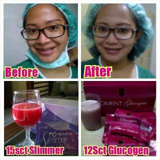 anggiSeo's tweet photo. cantik ,putih,tanpa jerawat ,tanpa flek hitam .yuu yg mau icip" m0ment gluc0gennya . chat aja ya({})
Pin:7EB7879B http://t.co/ODa7vwl8KW