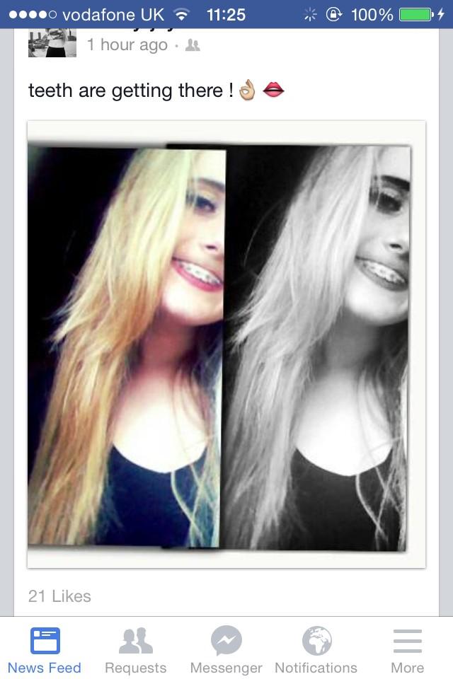 norwichcunts's tweet photo. Is her top lip okay???? http://t.co/I34ipbFDFw