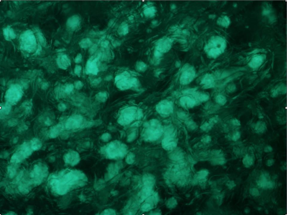 MolecularMatrix's tweet photo. Kidney Cancer Cells in GroCell-3D™ Scaffold through Fluorescent Stereomicroscope http://t.co/UpsPG2QLOx
