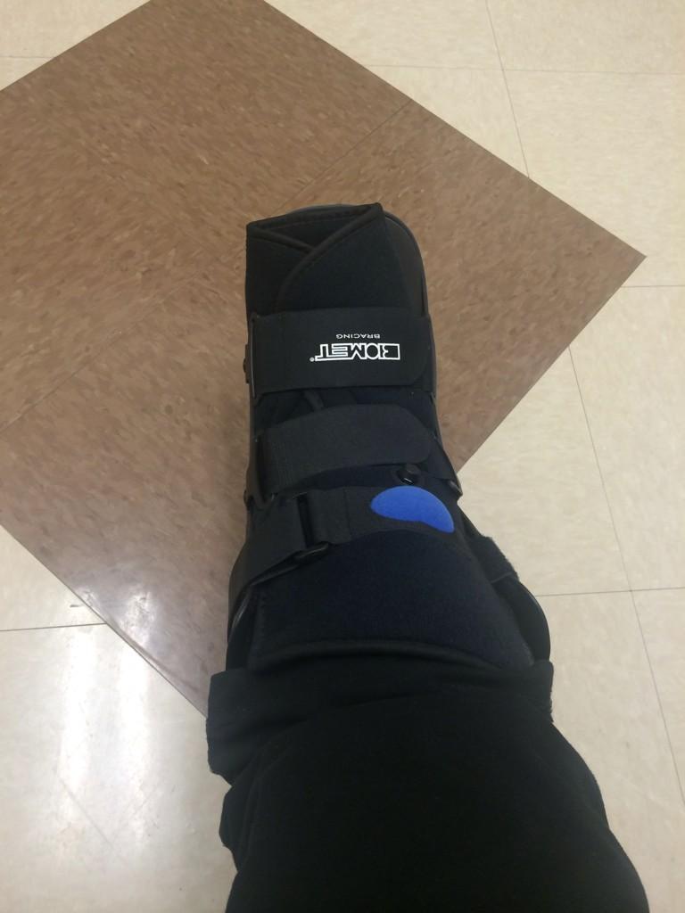 pamrmckay's tweet photo. This is how my day has shaped up! Broken foot! http://t.co/WlNCGZTFHi