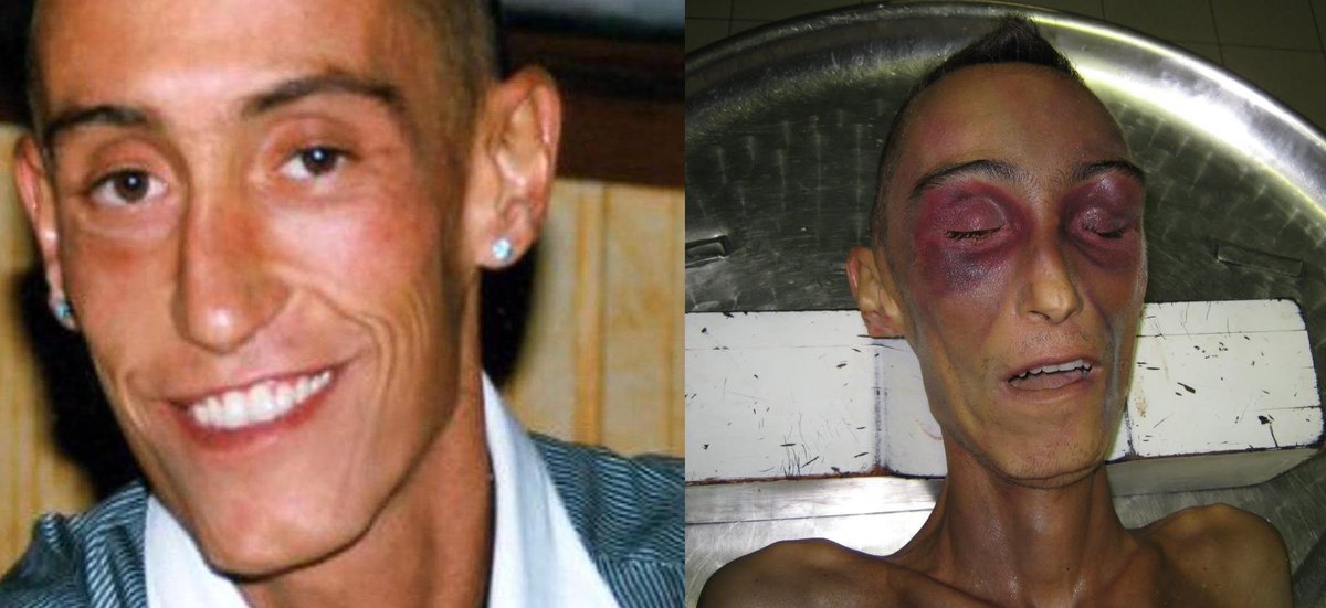 Peter Birro On Twitter Stefano Cucchi Is Me An Agonising Death In Custody That Shames Italy Http T Co R4ltx1cqu5 Http T Co 5rynu9lvqo