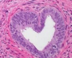 DrLaurenStuart's tweet photo. I ❤️ pathology! Happy International Pathology Day! #IPD2014 #pathologists http://t.co/VziygL0u1j