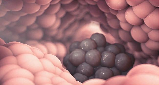 WebMD's tweet photo. Immunotherapy is a new way to attack cancer with your own cells.
#melanoma #leukemia
http://t.co/MLcxlTOCTV
^DrArefa http://t.co/cLwG6GFJFZ