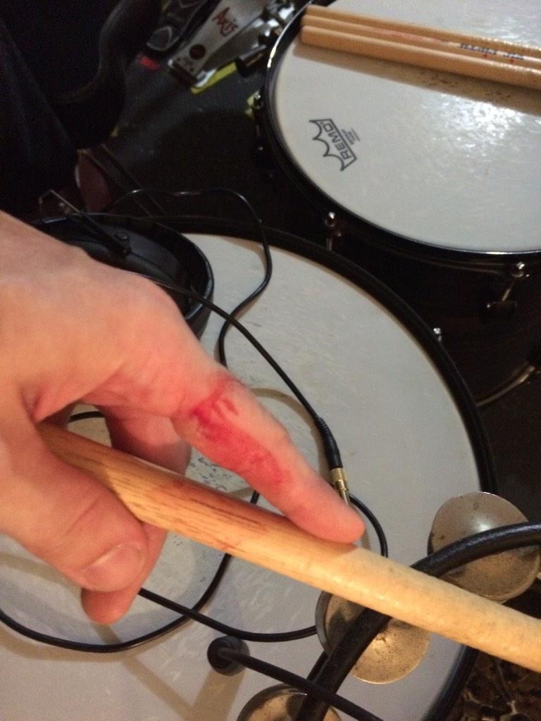 Jordansbeard's tweet image. Somewhere in the set this happened tonight #drummerproblems