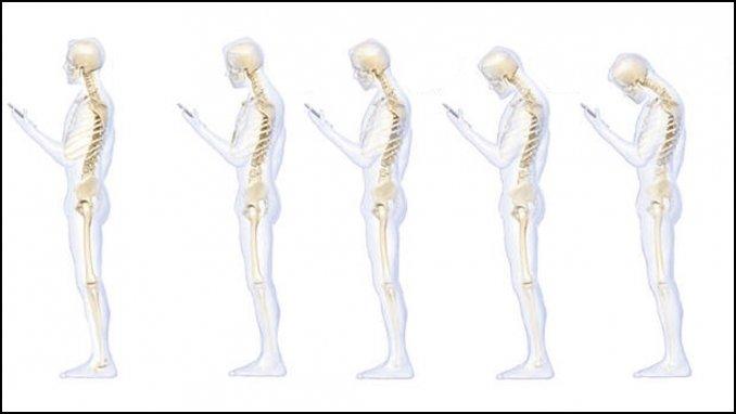 Así afecta a la columna el uso prolongado del celular goo.gl/V6jdQM