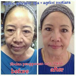 Lala yeye,,siapa mauuu mukanya kenceng g kena gravitasi bumi lg,,kantong mata ilang,,monggo chat me utk tau gmn crnya