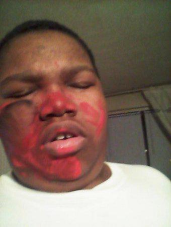 osheawatt's tweet photo. just got jumped by the rival gang again they blew my face up with grenade http://t.co/a3hDoxrs8k