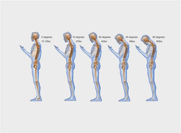 Got texting neck?  Looking down at your smartphone or tablet can exert up to 60 pounds (6 bowling balls) on your neck