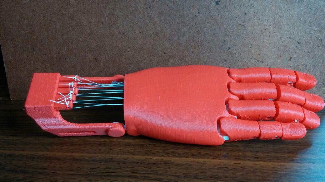 ProtipArt's tweet photo. Prótesis de mano funcional para #JeffersonMartins #impresion3d #protipart #innovación http://t.co/7fzK0EHy6A