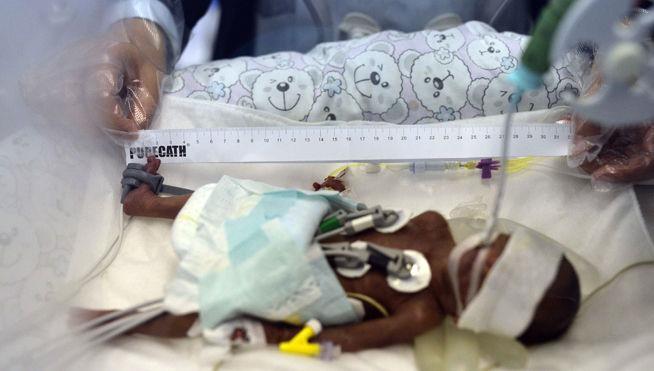 informativost5's tweet photo. Un bebé prematuro nace pesando 750 gramos en China http://t.co/OOmmdQ56W6 http://t.co/Lt4uS6A6bM