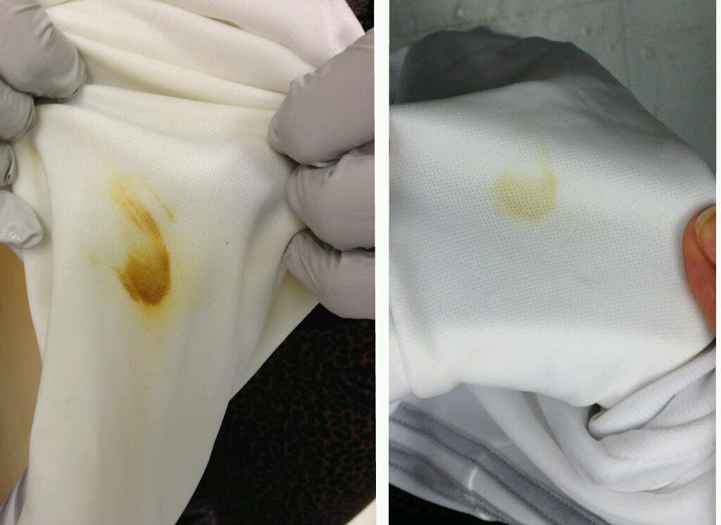 Sciency_Jax's tweet image. Not bad for an #Iodinestain that set for 2 hours. #Sodiumthiosulphate solution did the trick. #ChemistryIsAwesome