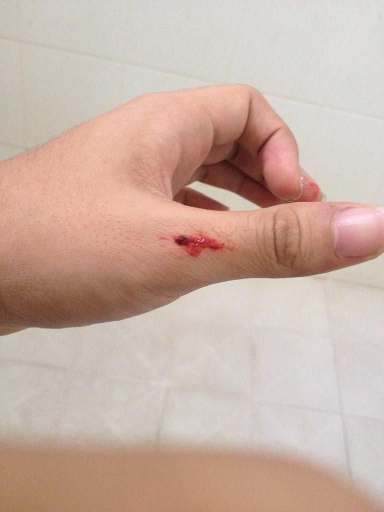 Rega_dauna6's tweet photo. Bangun siang dikasih nya darah sial -__- http://t.co/7hup83j1cC