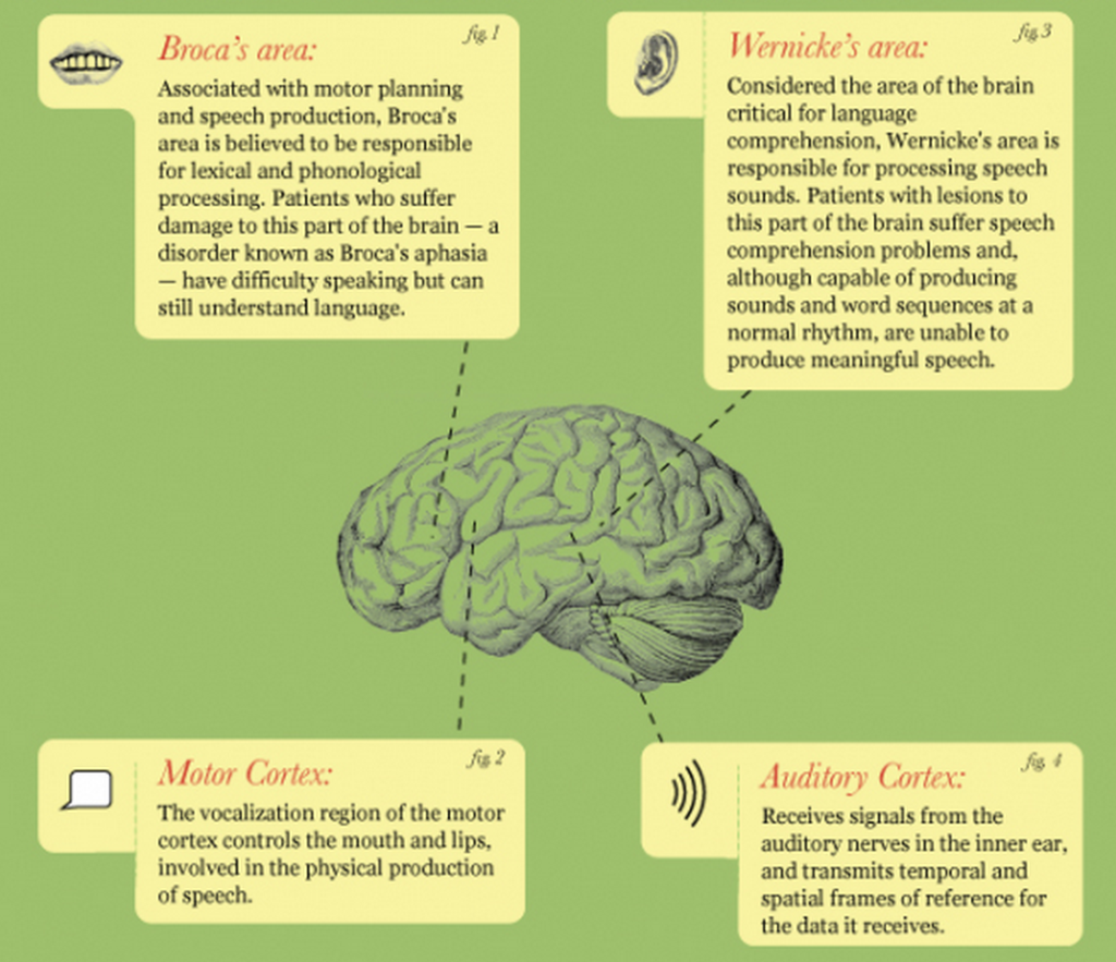 Brain languages. Мозг и речь. Language and Speech. Speech Disorders. Speech Brain.
