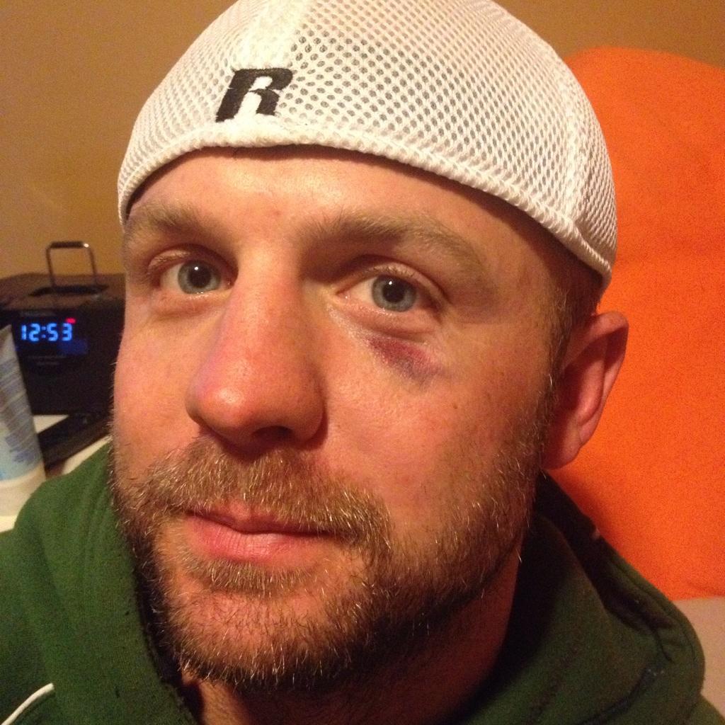 kennetconnell's tweet photo. Wow I'm sore but feeling great about the big WIN. Big ups to my boy @tygarland25 for Man'OMatch @cwrugby #nottheface! http://t.co/9db35K4dAh