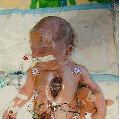TheMrX's tweet photo. Please #retweet first for prayers, and can we pray for this child??? http://t.co/rafxSZfzwy