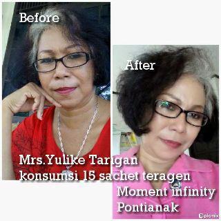 anggiSeo's tweet photo. bukan hanya putih cantik sehat menyeluruh . awet muda juga . yuu dic0ba gluc0gen nyaa  . Chat ya ..
Pin :7EB7879B http://t.co/m4JT9ldkTK