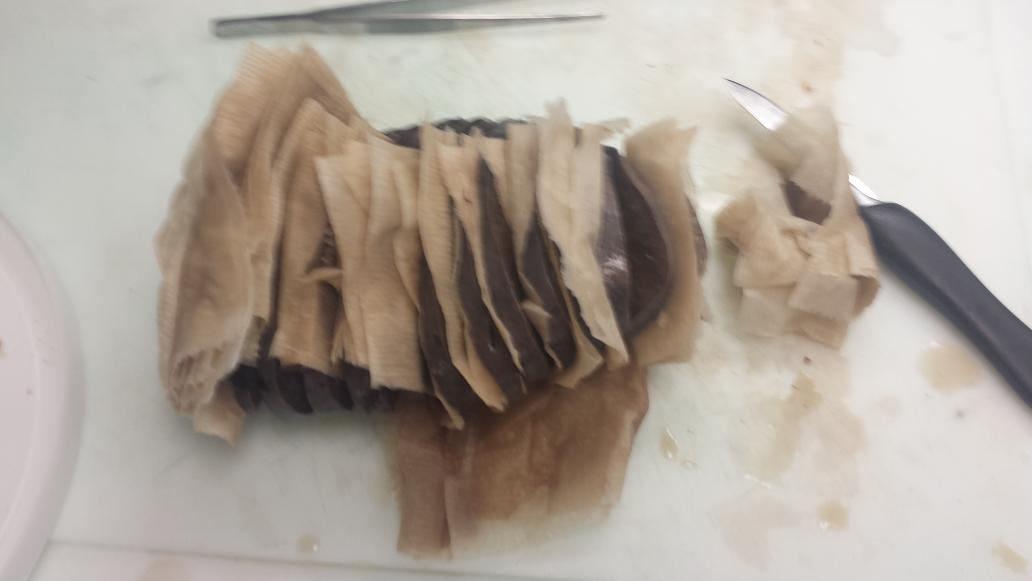 GSNeither's tweet image. Because no one appreciates my pathology pictures. This is NOT how you prep a spleen for dissection #PATHFAIL