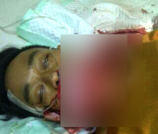 Metro_TV's tweet photo. Dijemput Teman, Audi Tewas Dikeroyok dan Dibacok http://t.co/9SqkCnd0cp http://t.co/PlKp3qiZnc