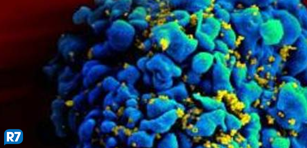 portalR7's tweet photo. Pacientes com Aids receberão medicamentos mais modernos http://t.co/No7N0IkIHu http://t.co/vN7xJ34drs