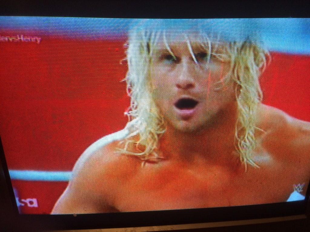 rontrellw1's tweet image. #zigglervshenry go zigg