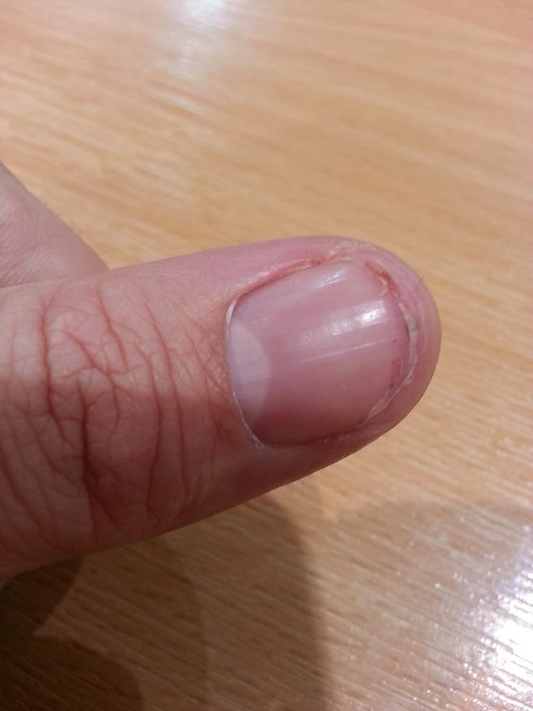 JonnyFun101's tweet image. Perils of the job ripped part of my nail off putting a customers key back on a key ring #grityourteeth