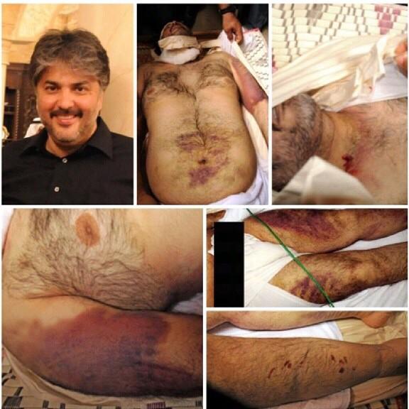 Roo7Jawad's tweet photo. #جرائم_التعذيب في السجون الخليفيه ومنتسبي اللا امن في الشوارع #البحرين http://t.co/n70TkKogYP http://t.co/2pngWHiejP