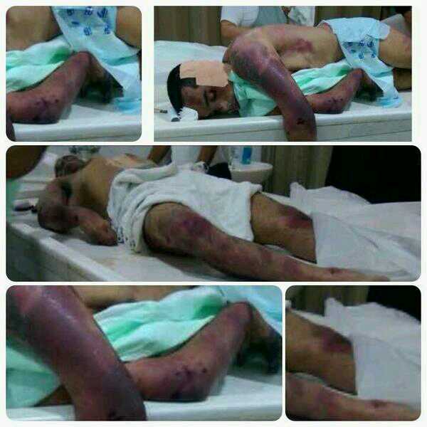Qatifyoon4BH's tweet photo. هكذا يتعامل النظام الخليفي مع المعتقلين ضرب حتى الموت داخل السجون #حسن_الشيخ عذب بداخل السجن حتى فارق الحياة http://t.co/d399D6vxxX