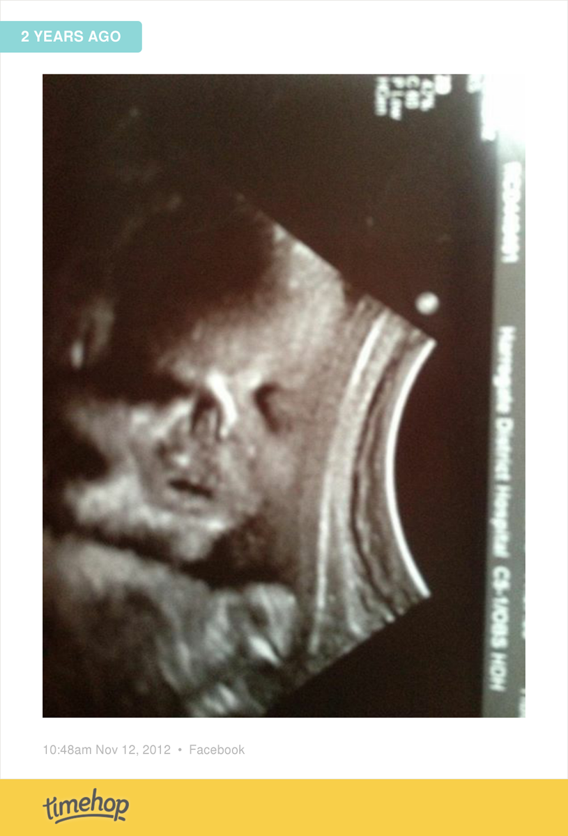kerrisfleckney's tweet photo. Baby James  http://t.co/qWs2fWmR9I http://t.co/irGwYz0QIa