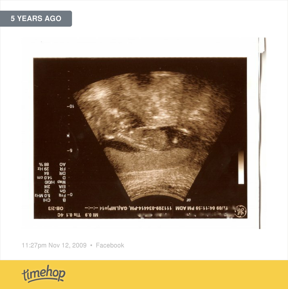 kylie76's tweet photo. Five years ago.   http://t.co/6bQP8kY2FG http://t.co/zTpxQxRwZK