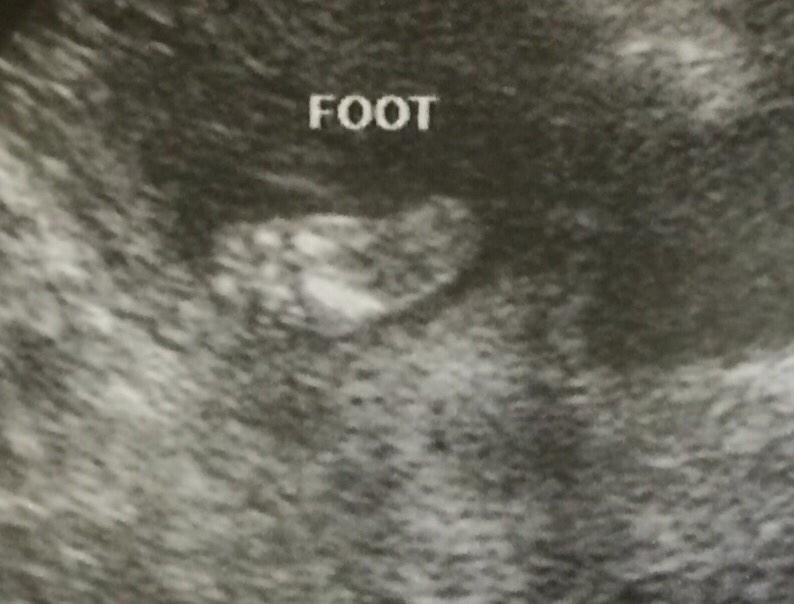 lost_cat's tweet image. I'm going to be a grandma :)