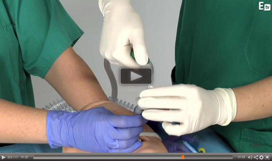 Enfermeriatv's tweet photo. Hoy os enseñamos cómo aspirar a un paciente intubado http://t.co/KRLFKLLOHV #Enfermeria #inves14 #formacion #Salud http://t.co/aMxmzA2Z4W