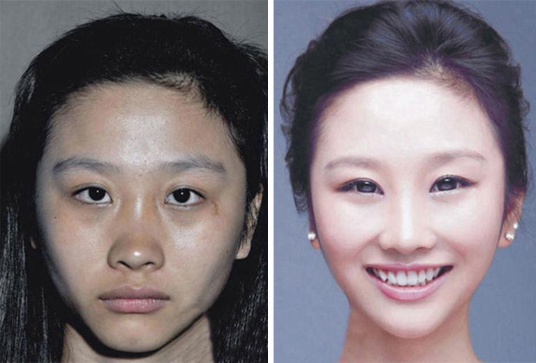 These women have had SO much plastic surgery, they can't get through a...