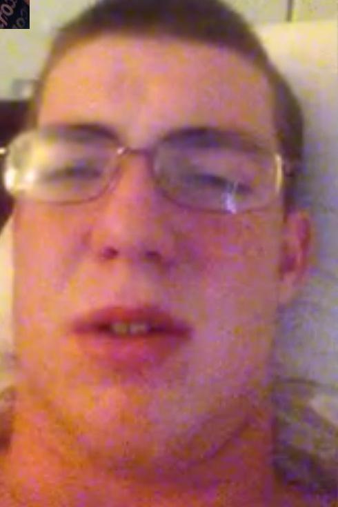 Lima_Bean_Smith's tweet photo. When you get out ur wisdom teeth http://t.co/QwOPIGiY4N