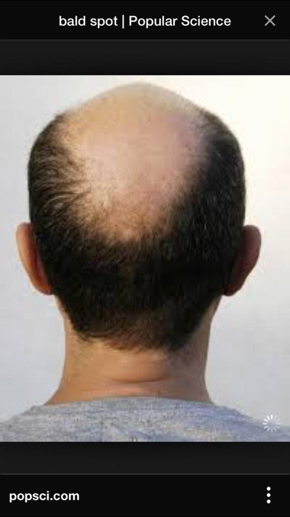 daniel85eden's tweet photo. Everyone like the raynors new cut?? #sidebush http://t.co/asrs3sEzBh