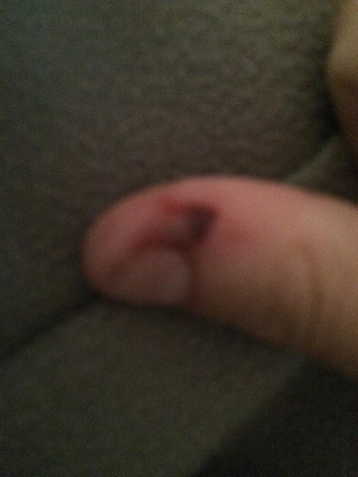 Looks worst in person but yea crazy ass bitch stabbed me 3 times while sleeping and when I call cops<a href="/tag/foodporrn"class="tags"><span>#foodporrn</span></a>