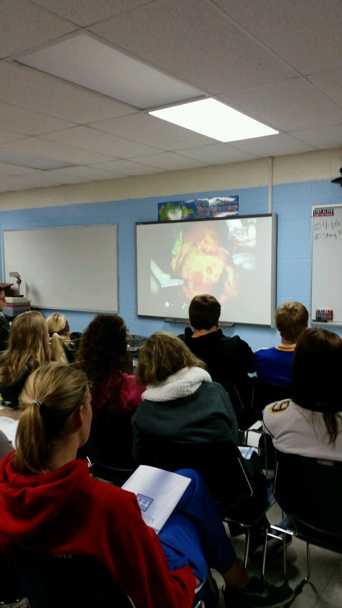 Students from ML and Minster viewing a live knee replacement surgery.  Technology provides opportunities!
