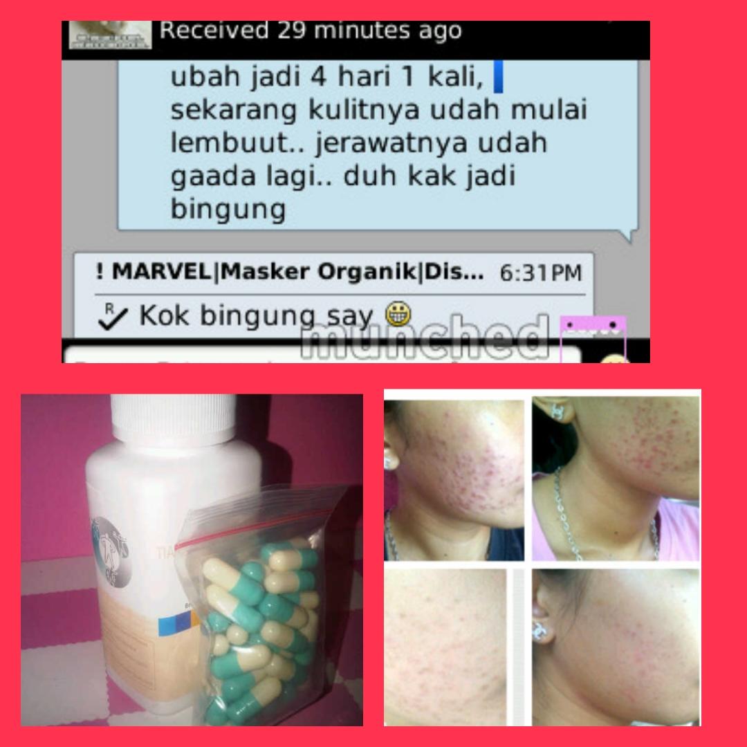 MaskerOrganik1's tweet photo. masker chitin solusi alami bebas jerawat!! info produk hub marvel pin. 3253099E http://t.co/is8U0oRQlt