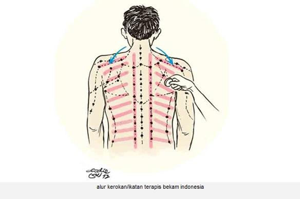 infojogja's tweet photo. #tips | Teknik Kerokan → http://t.co/qTdayQeksp , 

http://t.co/Q9DM9aNFmU